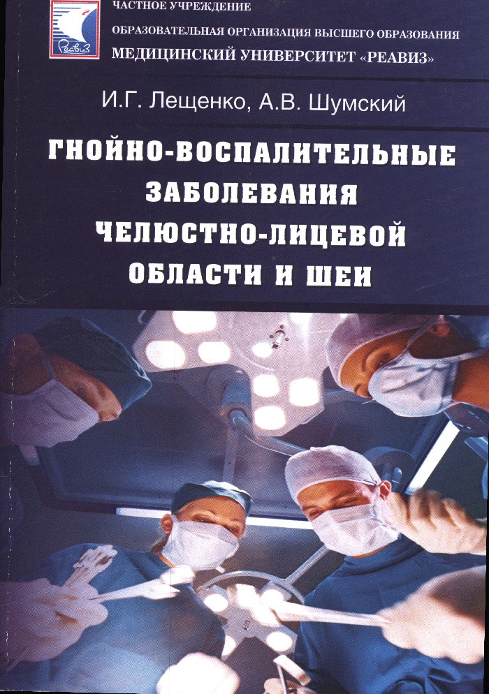 Одонтогенные воспалительные заболевания челюстно лицевой области презентация